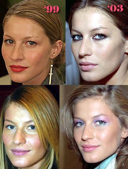 blake lively nose job. Celeb Nose Jobs - Obvious or