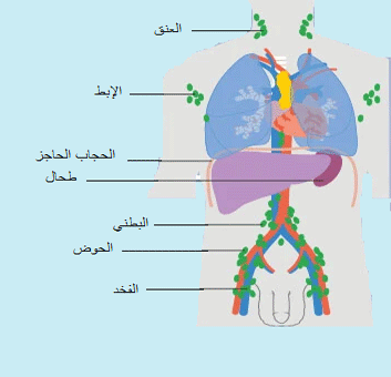 تضخم الغدد اللمفاوية