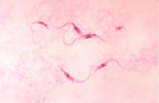 Tripanosoma cruzi 