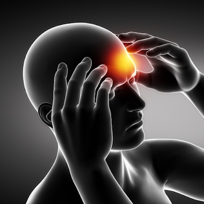 Headache: Types, Causes & Treatment