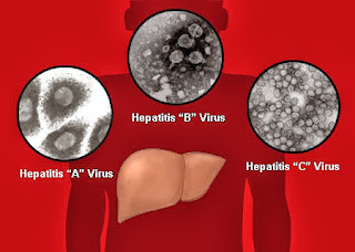 Mengenal Lebih Dekat Penyakit Hepatitis