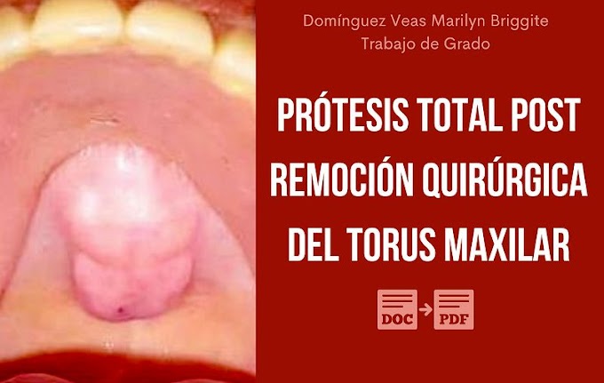 PDF: Rehabilitación con prótesis total removible post remoción quirúrgica del torus maxilar