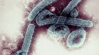 O vírus Marburg foi detectado pela primeira vez na cidade de Marburg, na Alemanha, em 1967