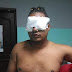 DELINCUENTES PENETRA A VIVIENDA DE HIJO DE PERIODISTA Y LE PUYAN LOS OJOS CON UNA TIJERA 