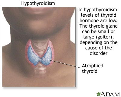 in the thyroid include: