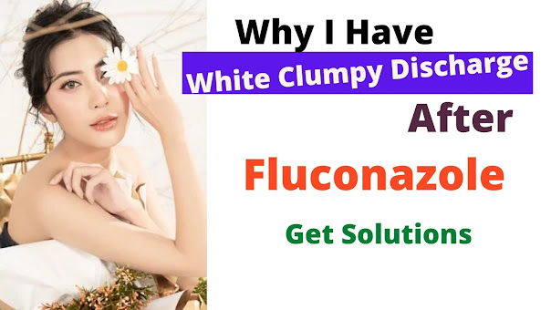 best solution white clumpy discharge with fluconazole
