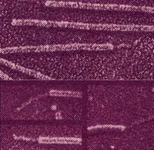 Enterotoxigenik Escherichia coli (ETEC)