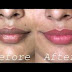 How To Lighten Dark Lips And Get Pink Lips Fast  And Naturally At Home Remedies