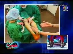 ศัลยกรรมเกาหลี ทำขา TonightShow Leg Surgery