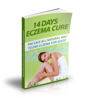 eczema cure . type of cure