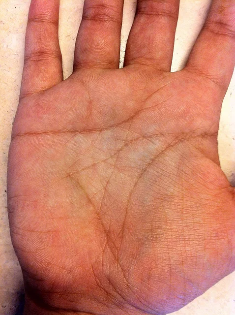 Sign Of Bankruptcy In Palmistry