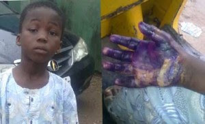 Cruelty! Woman Burns 7-Yr-Old Stepson’s Hand On A Stove