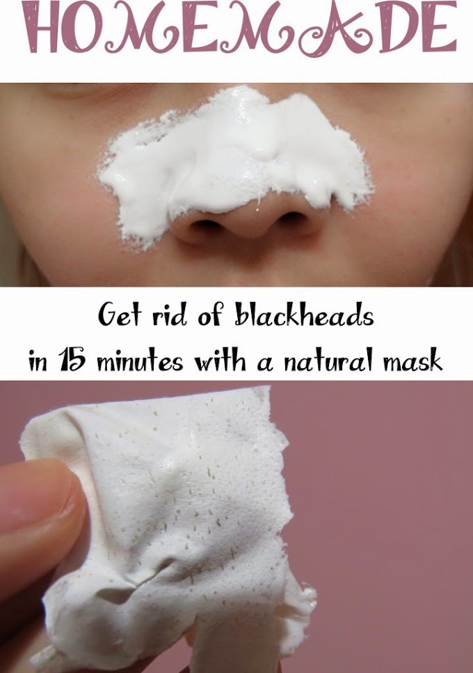 How to Remove Black Heads at Home