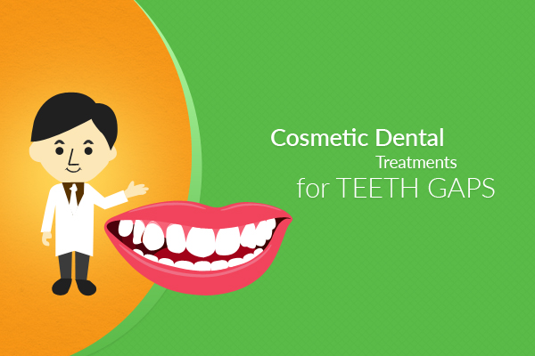 cosmetic dental treatments for teeth gaps