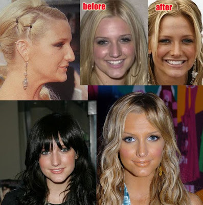 hairstyles of hot and sexy girl ashlee simpson nose job photo gallery