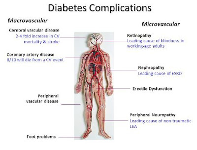 How to Prevent Diabetes Complications