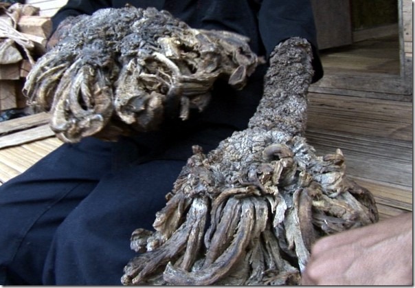 hombre arbol antes y despues (1)