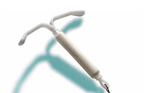 How Is An Iud Inserted. contraptions called IUDs.