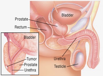 https://www.best-urologist-doctor.com/uro-oncology-prostate-cancer.html