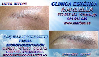 micropigmentyación MARBELLA clínica estetica ofrenda los deseable servicio para micropigmentyación, maquillaje permanente de cejas en Sevilla y marbella