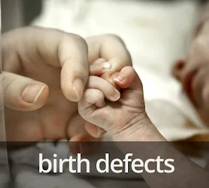 birth defects