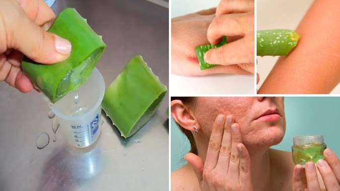 7 Reasons To Rub Aloe Vera On Your Face and Skin - Aloe Vera Benefits for Skin