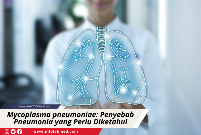 Mycoplasma pneumoniae Penyebab Pneumonia yang Perlu Diketahui
