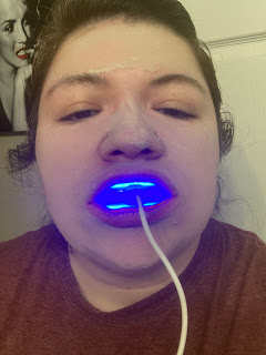 Teeth whitening device