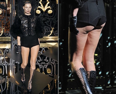 kate moss louis vuitton cellulite. Katemosslouisvuitton