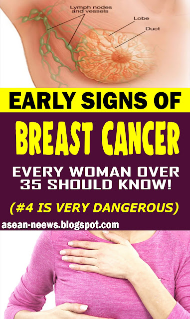 Rarely Discussed Early Warning Signs Of Breast Cancer