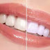 3 Quick Ways For Natural Teeth Whitening