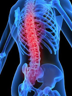 imagen de un esqueleto que denota dolor en la zona baja de la columna vertebral (zona lumbar)