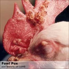 is bronchitis a chest contamination