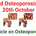 What is osteoporosis? - 20th October World Osteoporosis Day: