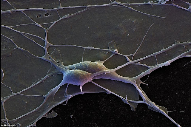 Нейроны коры головного мозга человека с взаимосвязанными дендритами