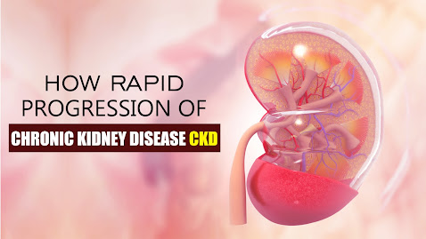 How Rapid Progression of Chronic Kidney Disease CKD