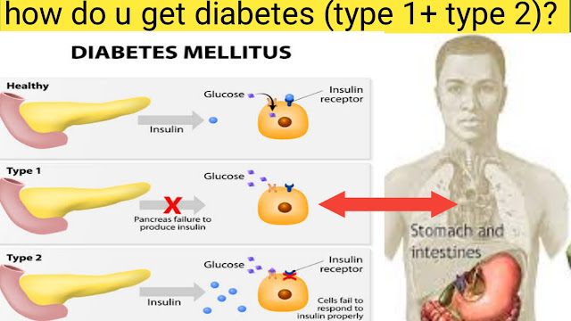 how-do-u-get-diabetes-type-1- type-2.jpg