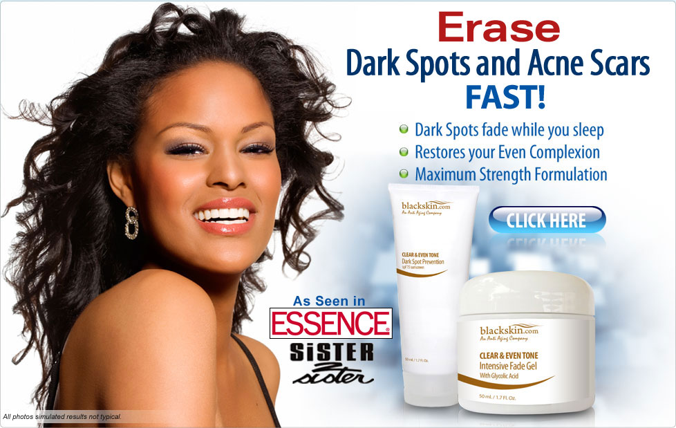 Skin+Cream+For+Dark+Spots Best Skin Care Products: Black Skin Care