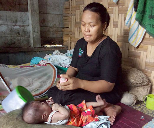 Zikri balita penderita gizi buruk asal Tanjungbalai bersama ibunya.