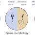 How To Increase Your Sperm Count Naturally