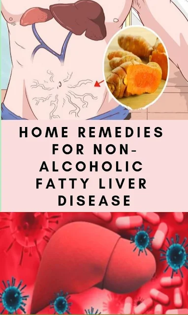 Home Remedies For Non-Alcoholic Fatty Liver Disease