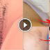 IMPRESSIVE! How To Naturally Remove Body Hair Permanently ( No Waxing Or Shaving )