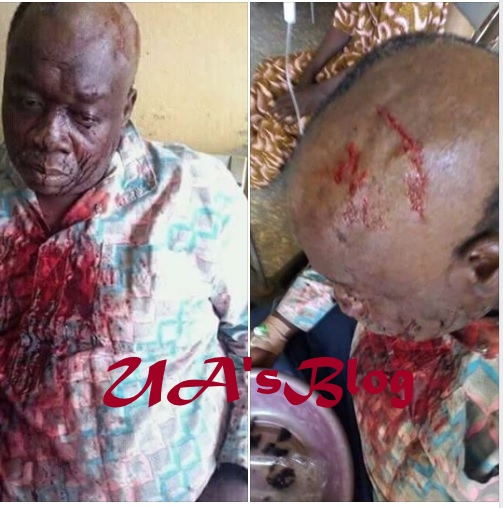 Thugs Break Head of Former APC Chairman For Defecting To Another Party (Photo)