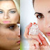 5 Ways Ice Can Improve Your Skin Health, You Must Try #5
