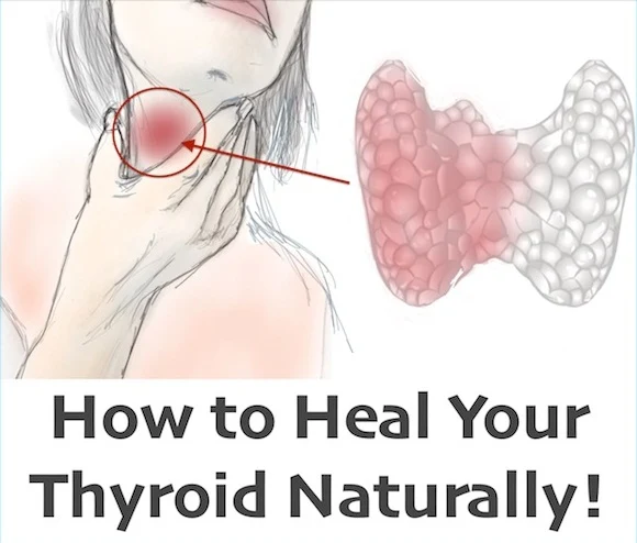  How To Heal Your Thyroid Naturally