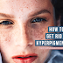 How to Get Rid of Hyperpigmentation