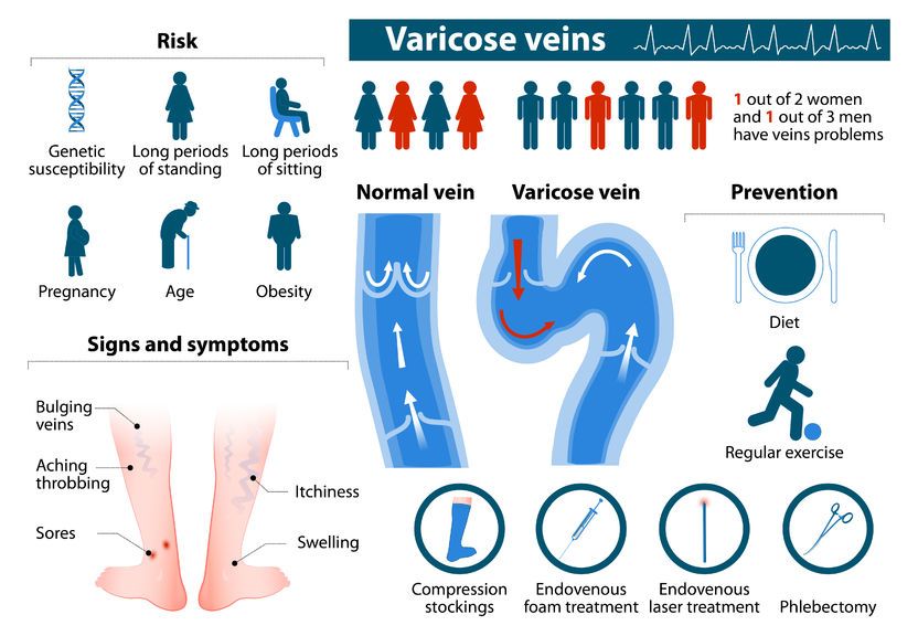 Venous-disease-infographic-nerdyrockson