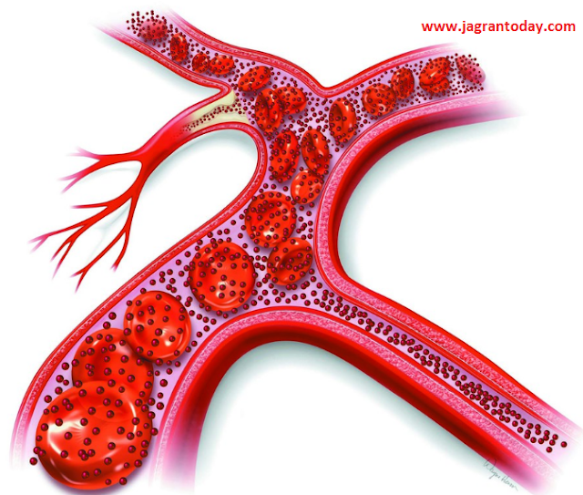 Kaise Karen Girte Hemoglobin mein Ijjafa