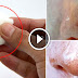 How To Get Rid Of Blackheads On Nose And Face!