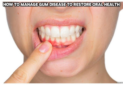 How to manage gum disease to restore oral health. In this post, we'll explore the various treatment options for gum disease and the importance of seeking timely care.